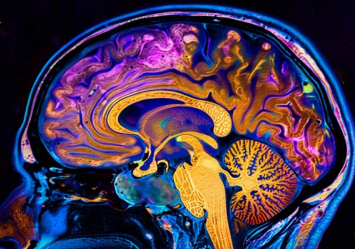 ketamine-brain-activity-neuroscience-1155x770